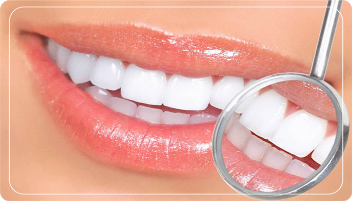 Diş beyazlatma nasıl yapılır?