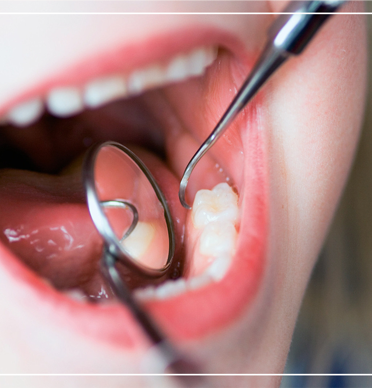 iltihaplı diş ağrısına ne iyi gelir?